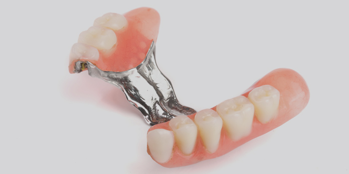 Confection de prothèses dentaires